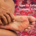 How to Relieve Diabetic Itching